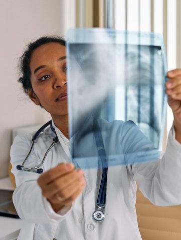 doctor holding up x-ray of human ribcage